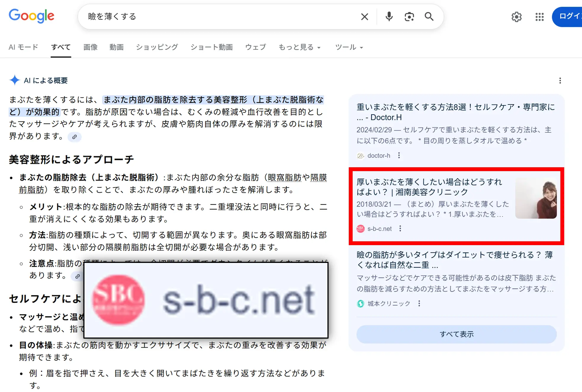 検索：瞼を薄くする